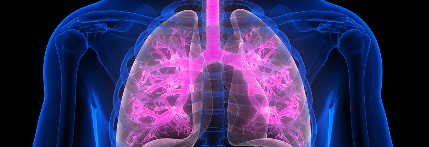Developing a Novel Anti-Inflammatory for Patients with Severe Asthma