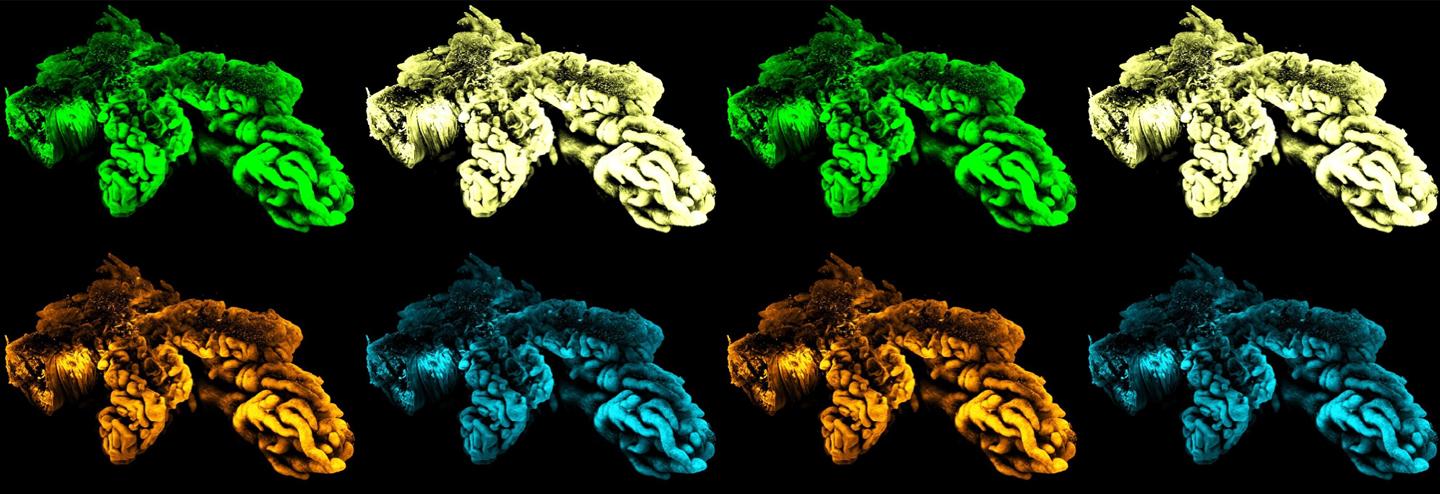 Accelerating Drug Development with AI-Enabled 3D Spatial Biology
