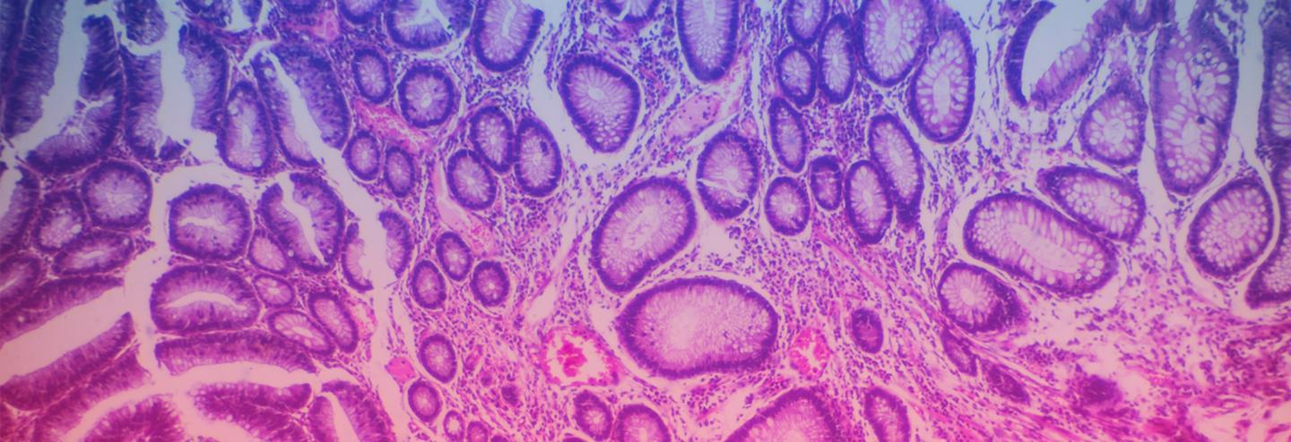 The Power of RepliGut In Vitro Intestinal Stem Cell Models
