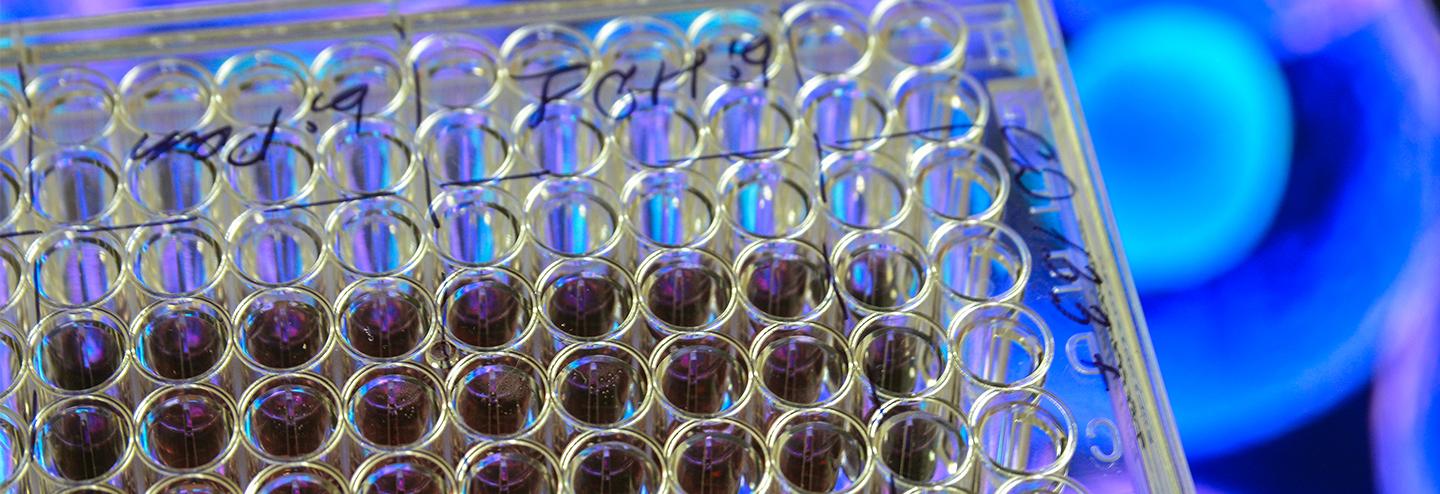 Championing In Vitro Biocompatibility/Biological Reactivity Testing for Plastics Used in Pharma Manufacturing