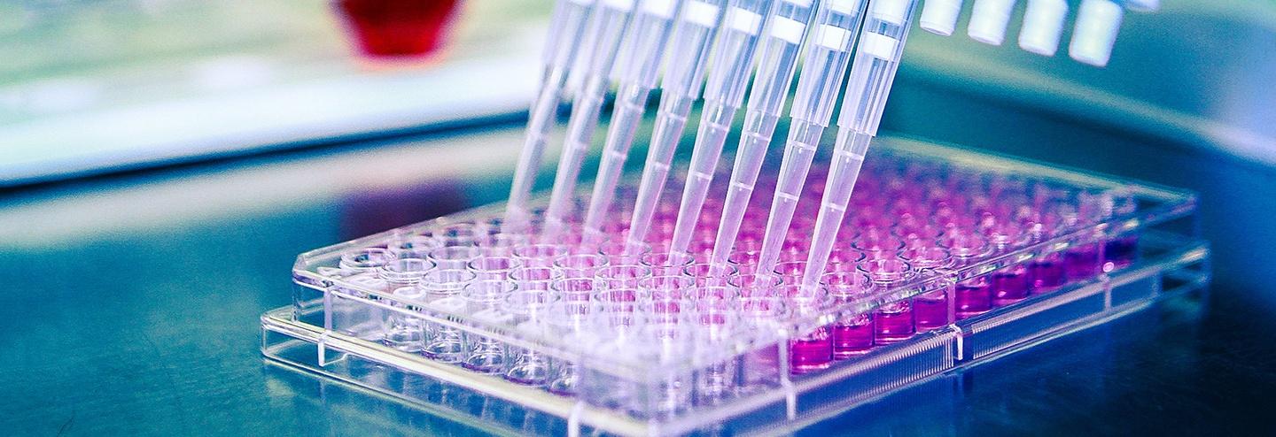 Analytical Methodologies Utilized in Therapeutic Viral Vector Manufacturing