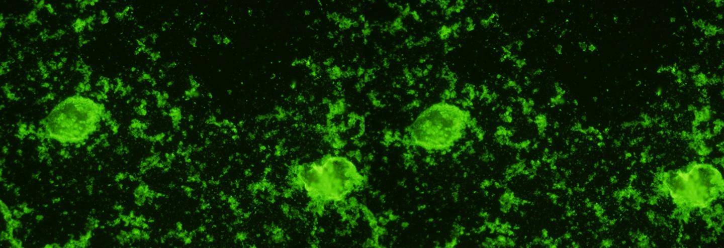 New Entamoeba Histolytica Monoclonal Antibodies