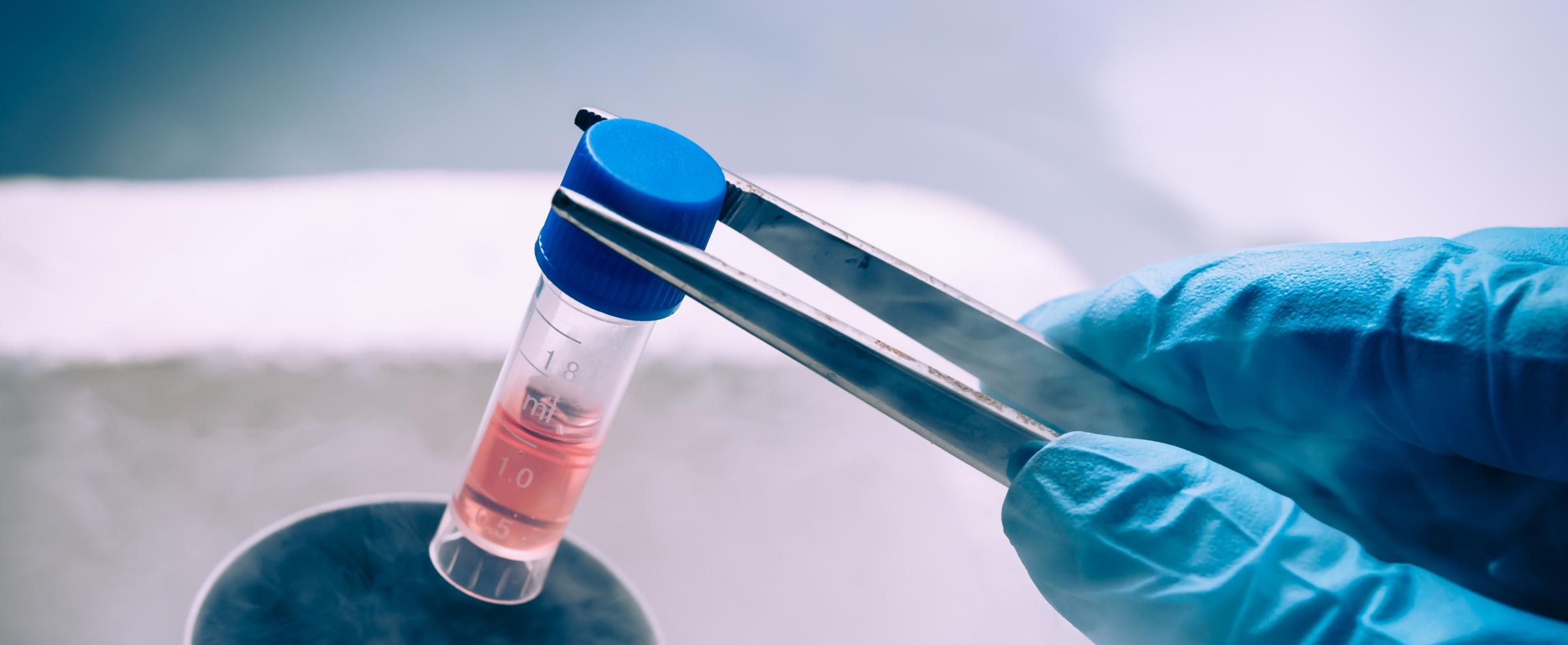 From Research to Clinical Trials to Commercialization: Advancing CGT with Frozen Cellular Starting Materials