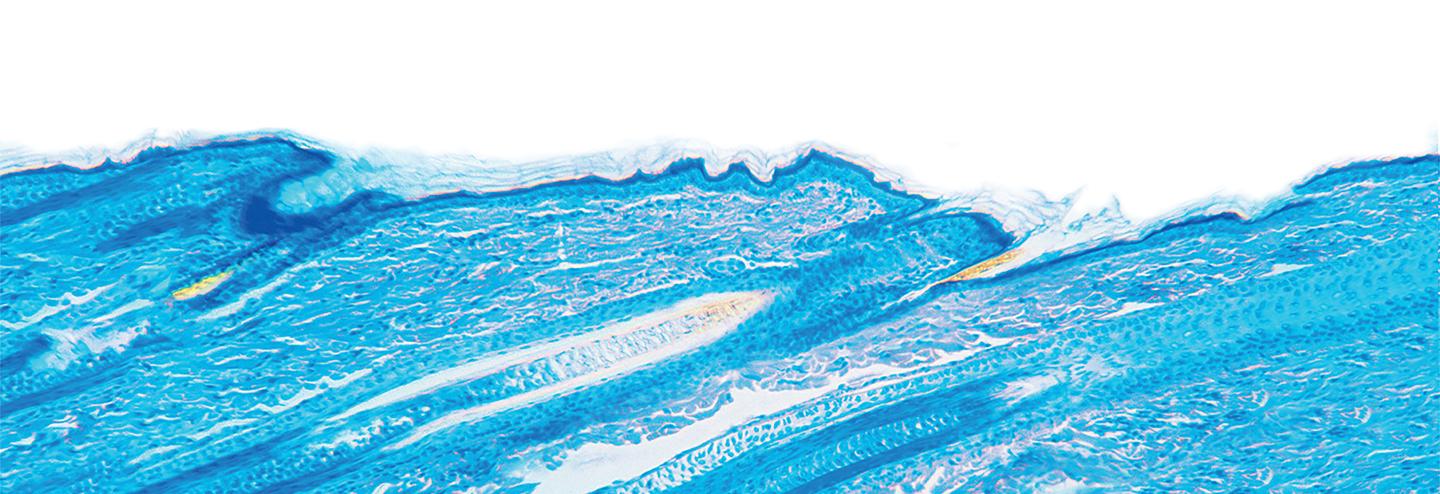 iPSCs: Moving from Drug Testing to Novel Cell Therapies