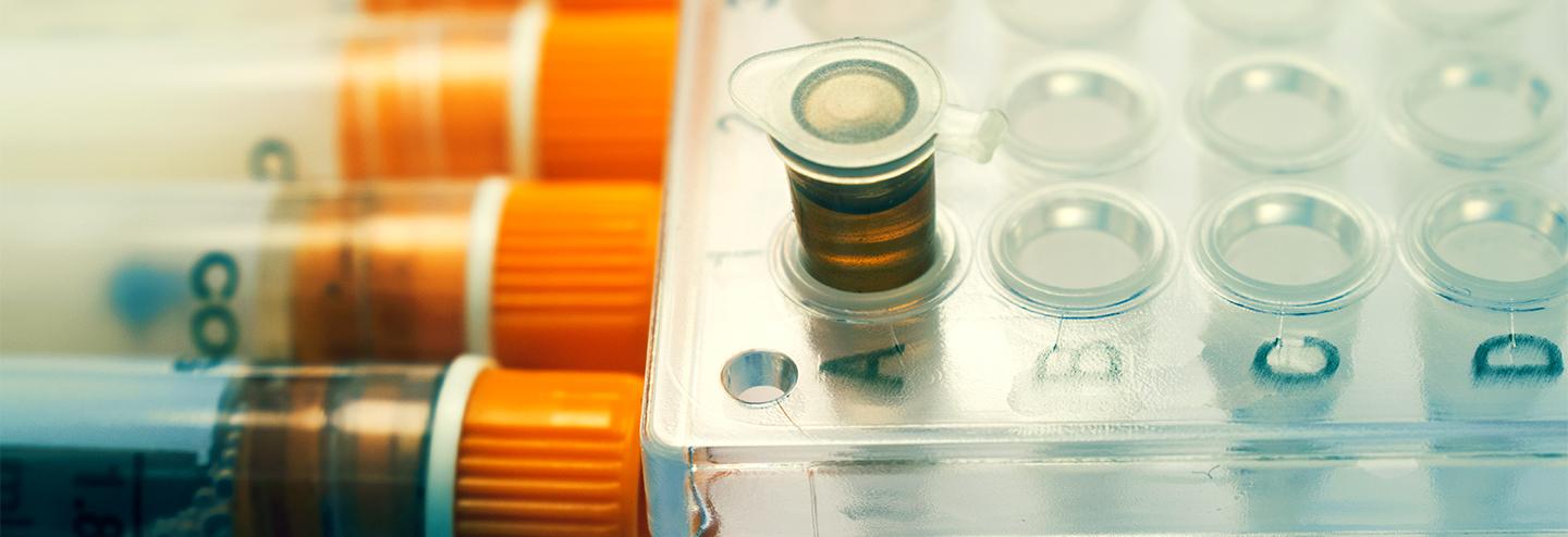 Applying the Principles of Immunotherapy to Infectious Diseases