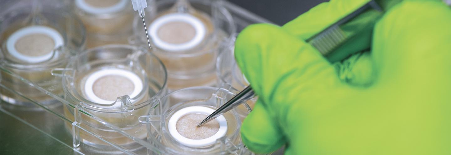 Overcoming Skin Assay Challenges with Living Human Models