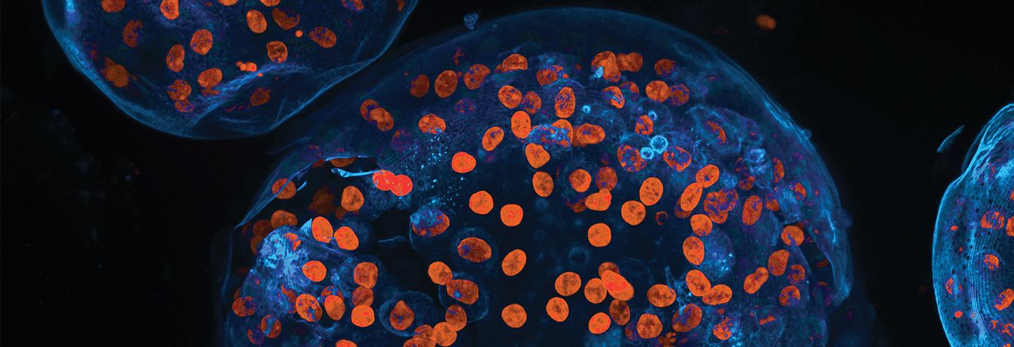 Disruptive Technologies in Life Sciences: Personalized Medicines