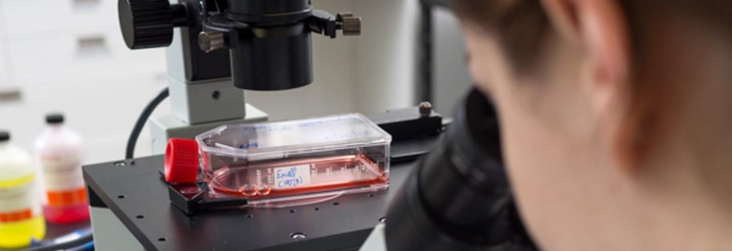 Optimizing Fed-Batch Processes with Chemically Defined Media and Feeds