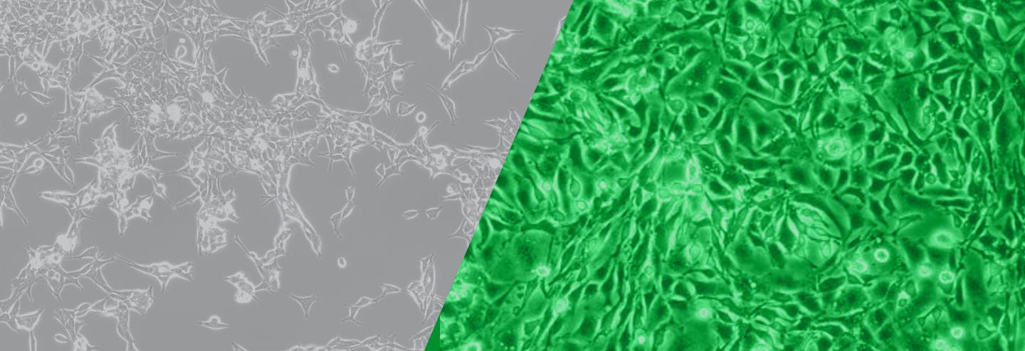 HEK Cells vs. CHO Cells in Recombinant Antibody Production: What's the Better Choice