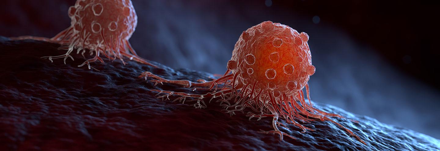 Moving from Autologous to Allogeneic Cell Therapies: Drivers and Hurdles