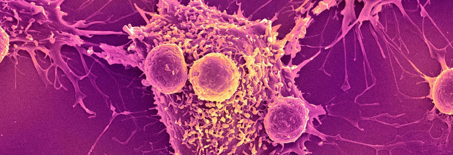 Cis-Targeted Immunotherapies Need Large CDMO Expertise But Also Flexibility