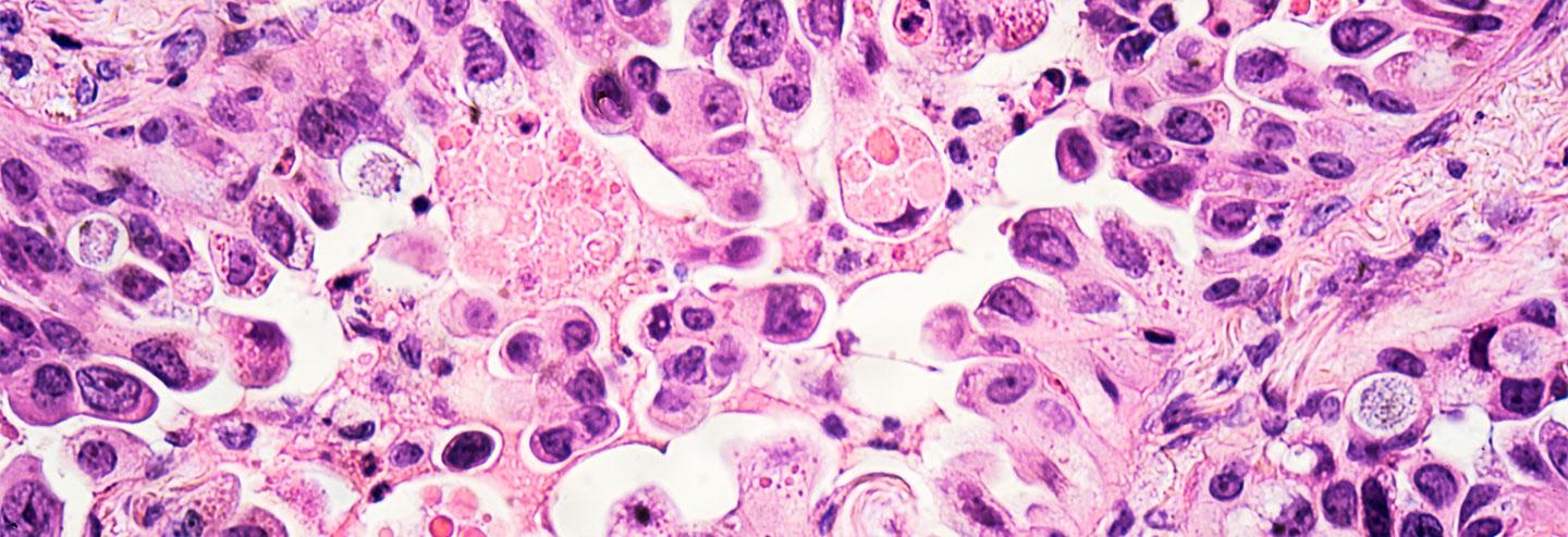 Advancing Disease Research and Drug Development on an Enterprise Pathology Software Platform