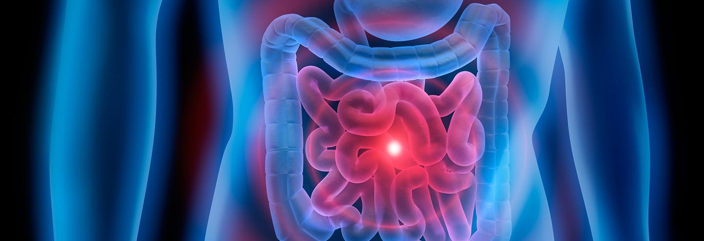 Recapitulating the Multifaceted Inflammatory Environment of the Intestine In Vitro