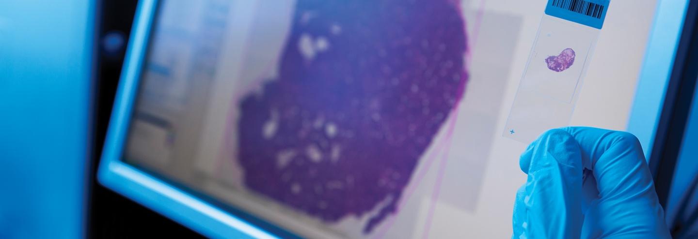 Achieving Large-Scale Cell and Gene Therapy Manufacturing