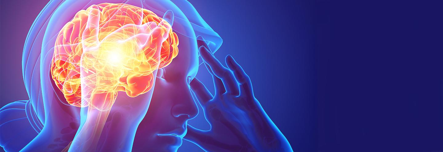 Mimicking Environmental Enrichment for Migraine Therapy