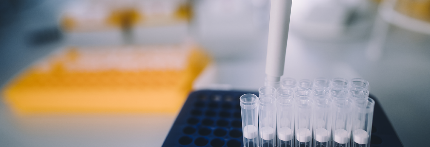 Navigating Analytical Requirements for GMP Viral Vectors