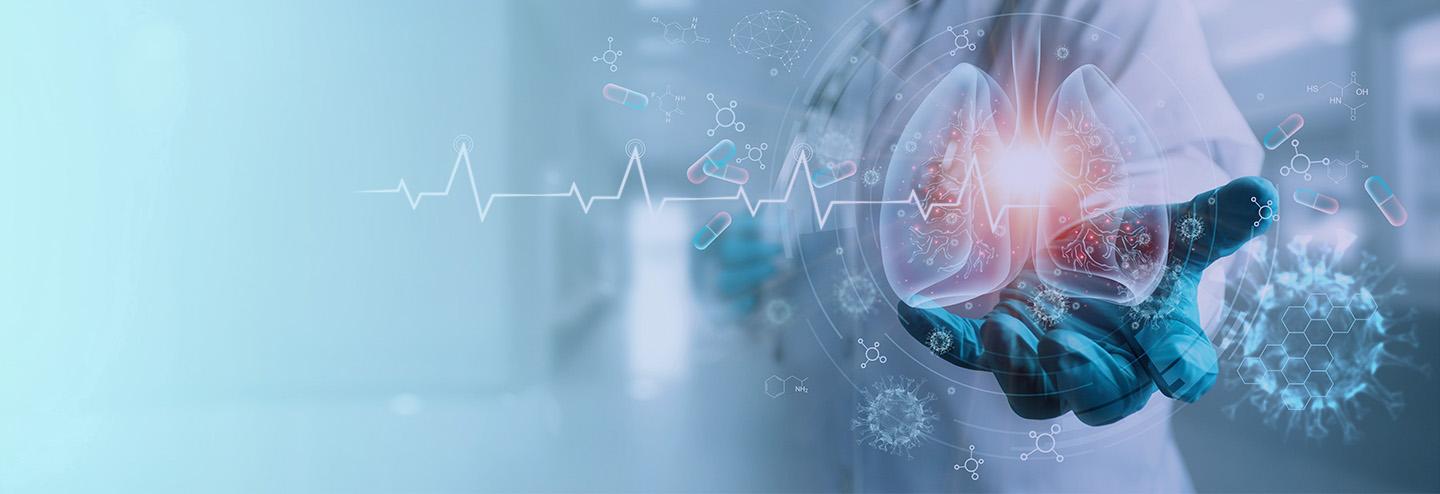 Accelerating the Development of a Novel Cell Therapy for COVID-19–Associated Lung Fibrosis