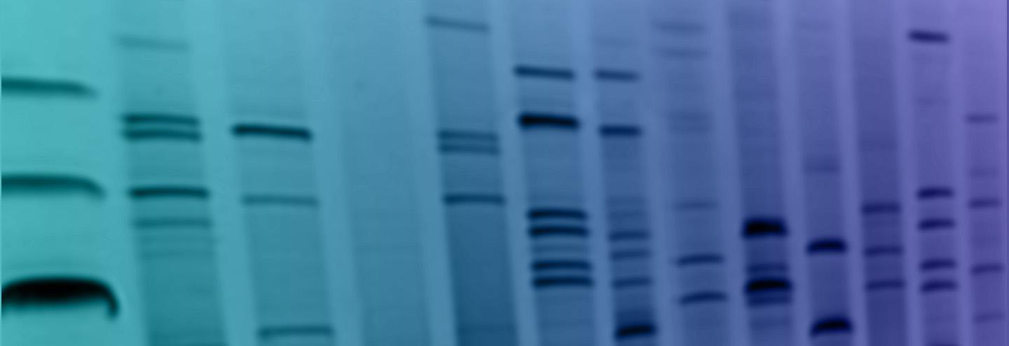 Serving an Accelerated Market with mRNA Production