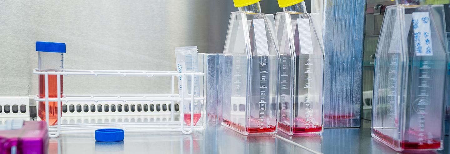 The Exciting Growth Curve for hMSCs Must Be Facilitated by Manufacturing Advances
