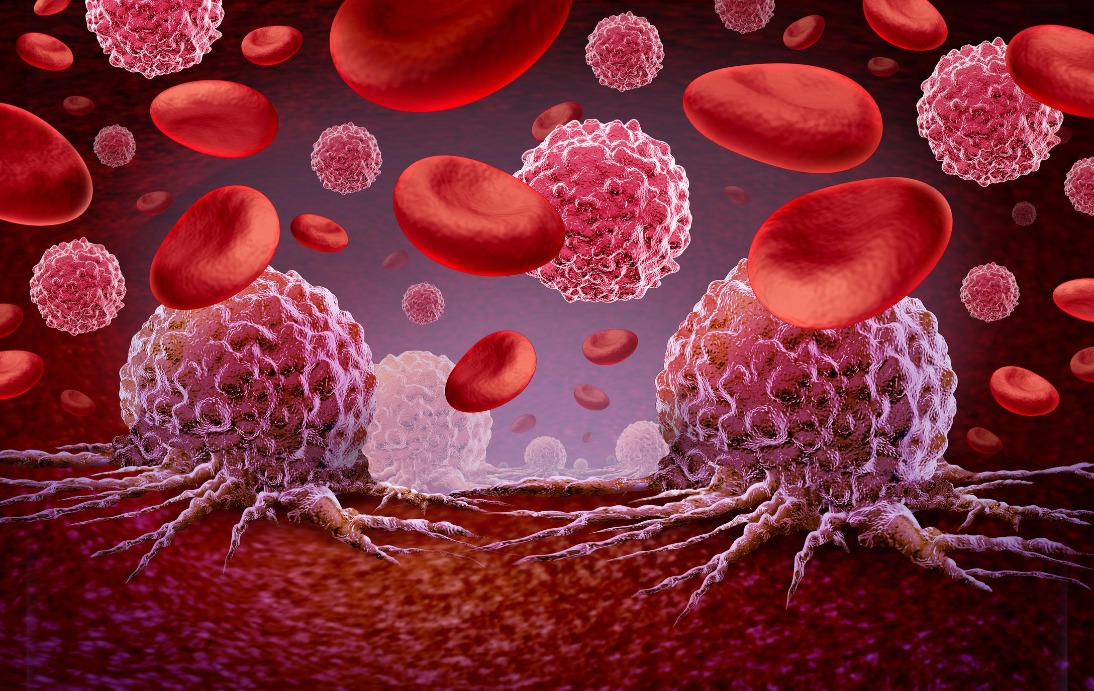 Measurable Residual Disease Moves Deeper Into Hematologic Cancer Development