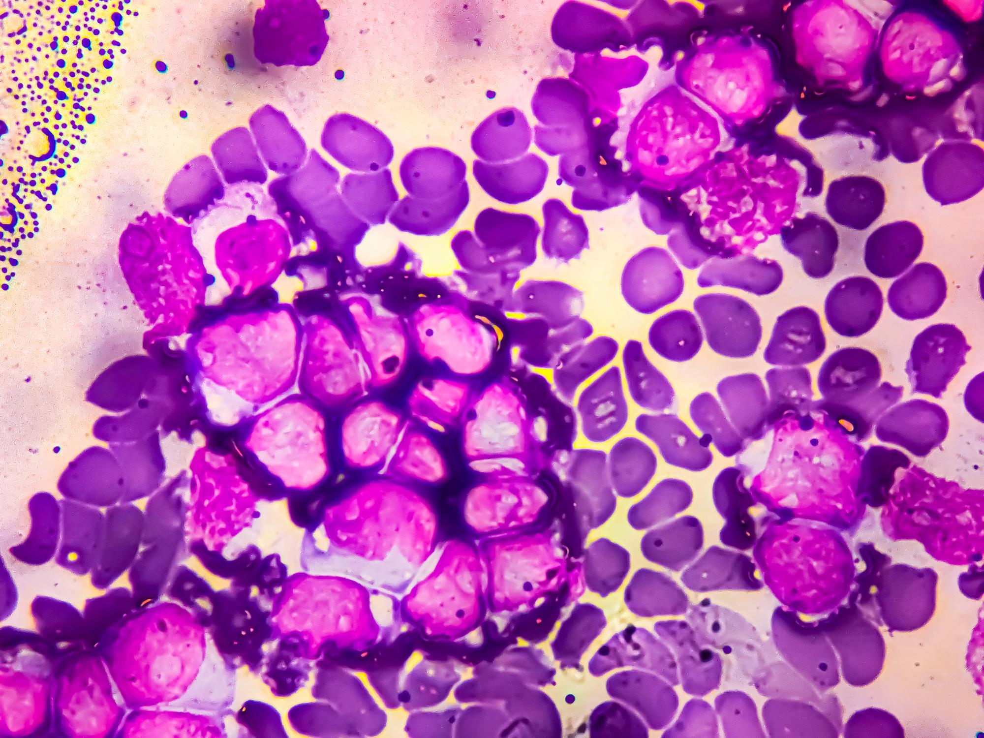 The Next Generation of Targeted Therapies in Hematologic Malignancies