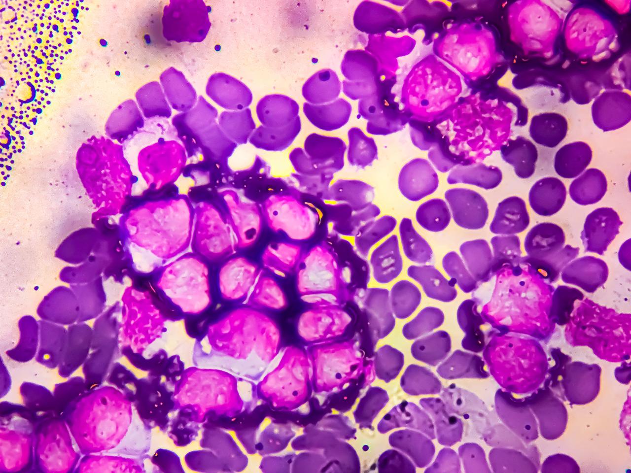 The Next Generation of Targeted Therapies in Hematologic Malignancies