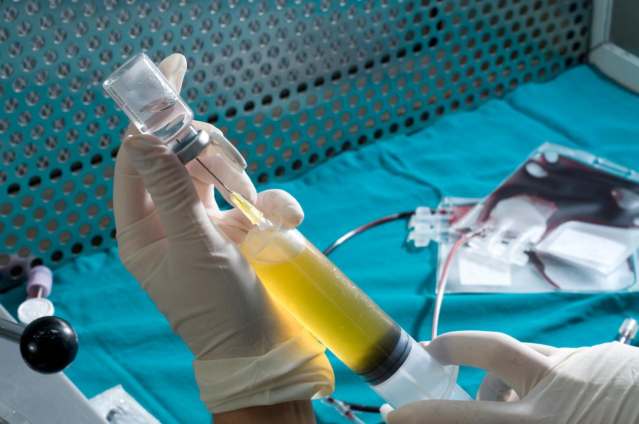 Overcoming Formulation and Fill/Finish Challenges for Cell Therapies