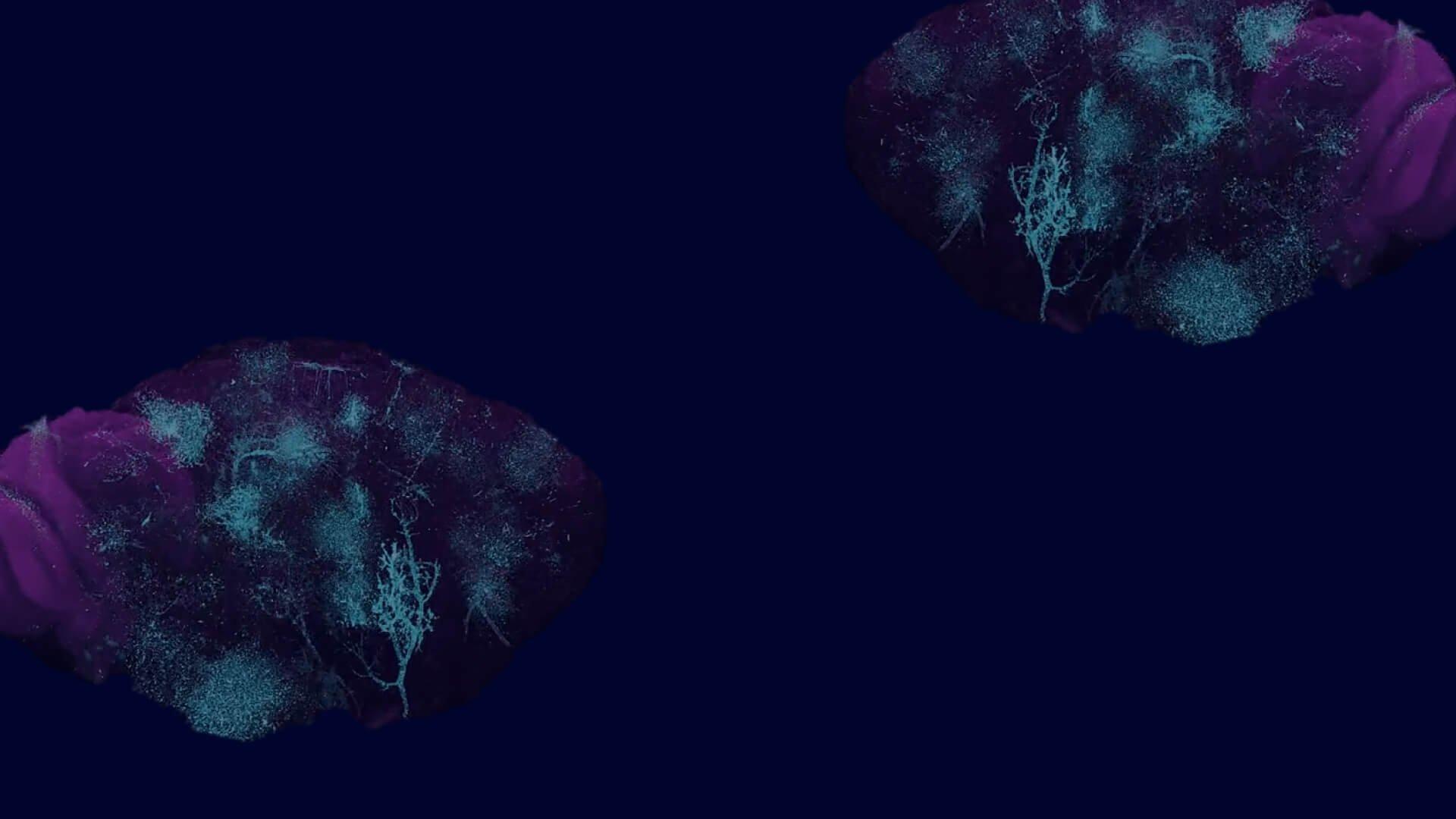 Alpenglow Biosciences (Formerly Lightspeed Microscopy)